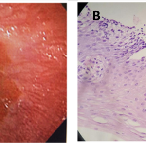 Fig1